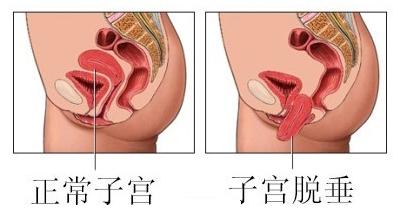 ӌmÓʮd ħЦ_(ki)