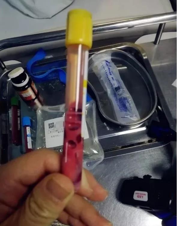 17qŮۼtɫѪݿMICUֻ@(x)Ts