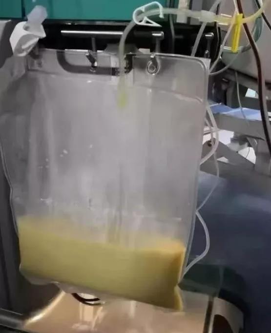 17qŮۼtɫѪݿMICUֻ@(x)Ts