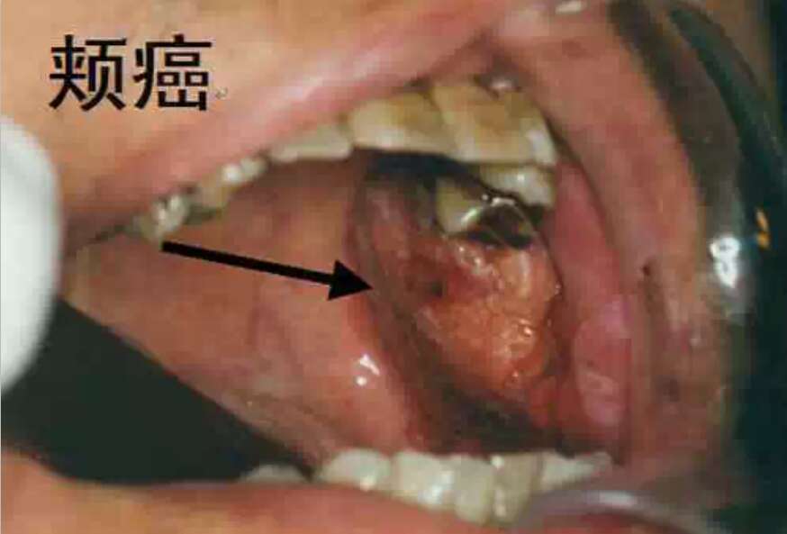 ǻϳĲ,ѣ@ķNF(xin)ĿǻT