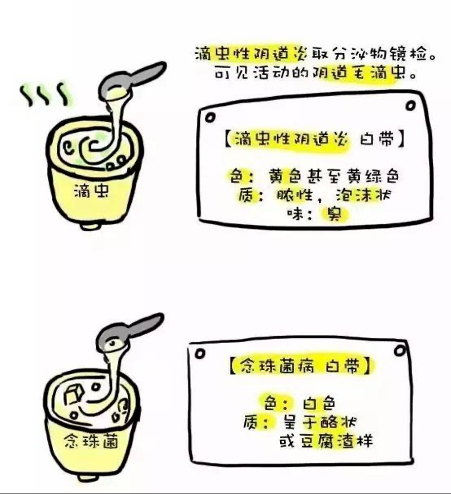 陰道炎很難治？分清類型正確用藥很重要！