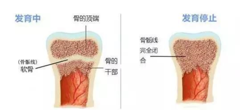 你家孩子又長高了嗎？