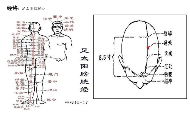 通天穴：主治頭痛，眩暈，鼻塞，鼻衄，鼻淵