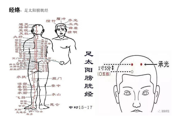 承光穴：主治頭痛、目眩、癲癇